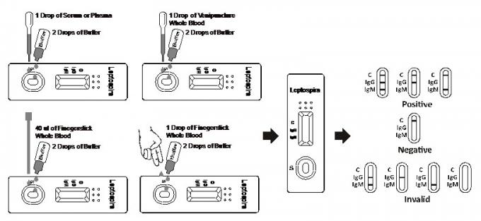 Μια Leptospira IgM/IgG ασθενειών LEP βημάτων τροπική εξάρτηση διαγνωστικής εξέτασης αίματος αντισωμάτων γρήγορη διαγνωστική