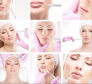 Hyaluronic όξινο υλικό πληρώσεως αφαίρεσης ρυτίδων