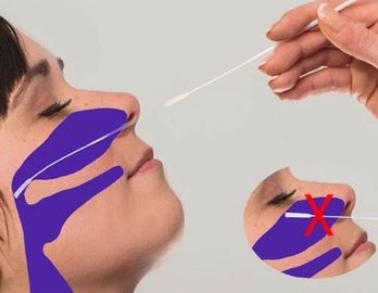 3ml συγκεντρωμένη το NP πατσαβούρα